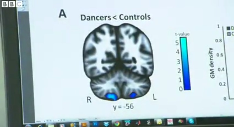 Why Don’t Ballet Dancers Get Dizzy When Pirouetting? [Video]